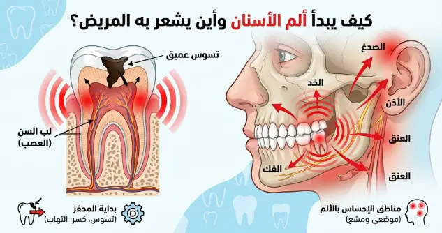 أعراض ألم الأسنان وتأثيرها على الجسم: كيف يبدأ ألم الأسنان وأين يشعر به المريض؟