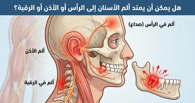 هل يمكن أن يمتد ألم الأسنان إلى الرأس أو الأذن أو الرقبة؟