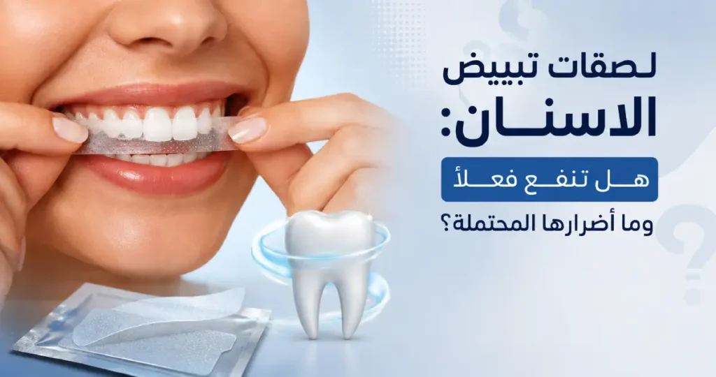 لصقات تبييض الاسنان: هل تنفع فعلاً وما أضرارها المحتملة؟