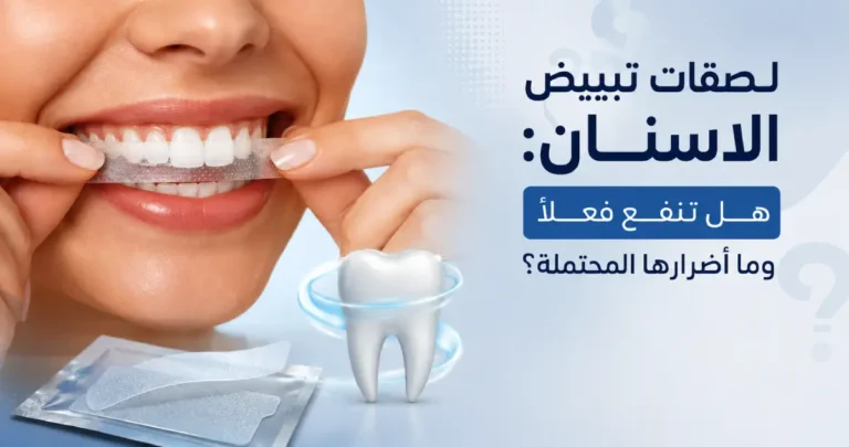 لصقات تبييض الاسنان: هل تنفع فعلاً وما أضرارها المحتملة؟