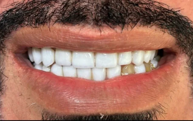 بعد